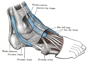 Peroneal Tendonitis