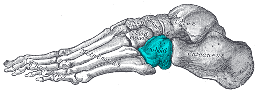 cuboid syndrome